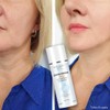 Ultra Lifting Day Cream for Mature Skin SPF 30 UVA