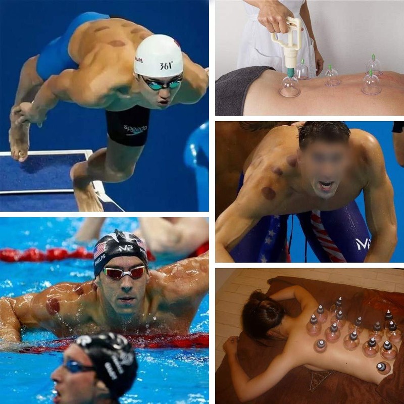 12 Cup Cupping Therapy Set, Chinese Cupping Therapy Set with