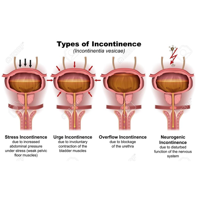 Bladder Regulator, Gosha Jinki Gan. an Effective Herbal Bladder Control