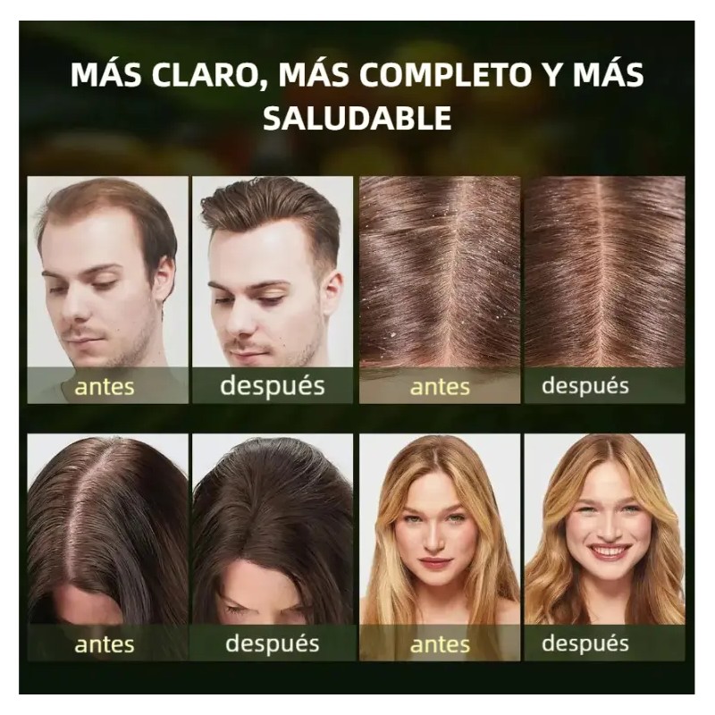 Shampoo Batana Oil Kit Pzs Shampoos 420ml Anticaida Tratamiento Capilar
