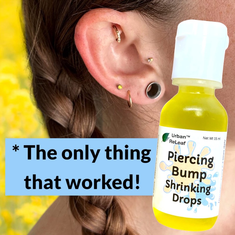 Urban ReLeaf Piercing Bump Shrinking Drops! Keloid Bumps Gentle Effective