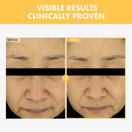 TOSOWOONG Eraser Liquid Patch with Niacinamide, Tranexamic Acid and Centella Asiatica Extract, 15g, 0.52 oz.