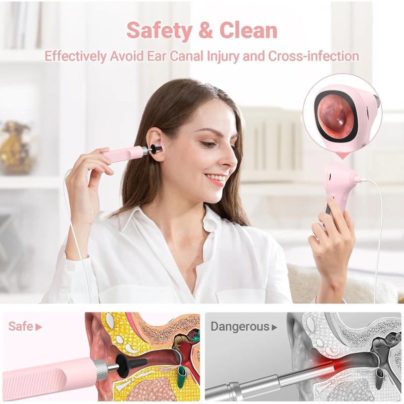 ScopeAround 3.9mm Otoscope 720p HD Smart Visual Ear Scope Camera