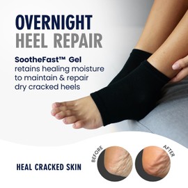 Dr. Frederick's Original Moisturizing Heel Socks for Dry Cracked Heels Treatment - Infused with Argan Oil, Aloe Vera Oil and Vitamin E - 2 Pairs - Stocking Stuffers for Adults - Black Argan