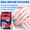 Pack of 42 Nail Fungus Plasters, Nail Patches, Nail Plasters,