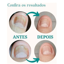 Maurelio Neto - Nail Repair Oil - 100% Natural Ingredients