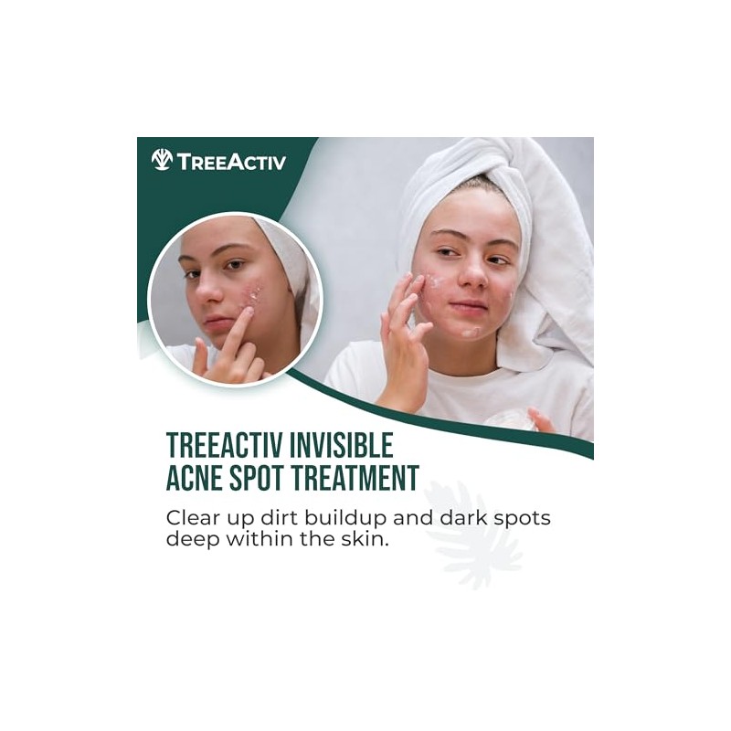 TreeActiv- Tratamiento invisible para el acné quístico con ácido salicílico