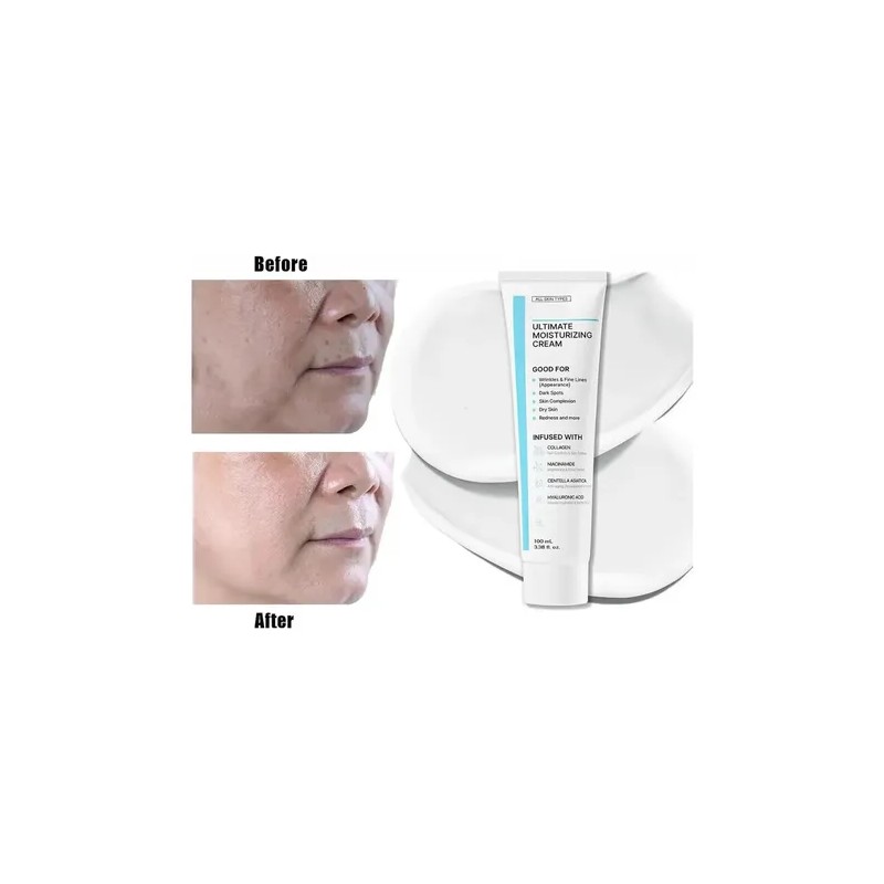 Crema Hidratante Definitiva De Frmula Juvenil, Crema