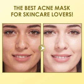 Mascarillas Faciales Para El Cuidado De La Piel, Paquete De