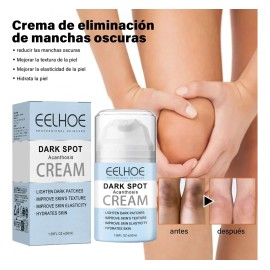 Crema Acantosis Nigricans Mejora Pigmentación Blanquea Axilas Unifica Tono Piel Hidrata Repara Articulaciones Brazos Rodillas