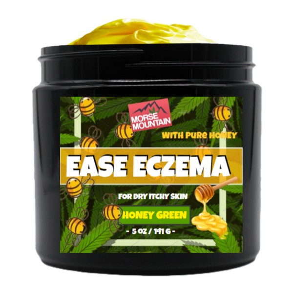 Eczema / Psoriasis Honey Ointment Cream Natural Dermatitis Treatment