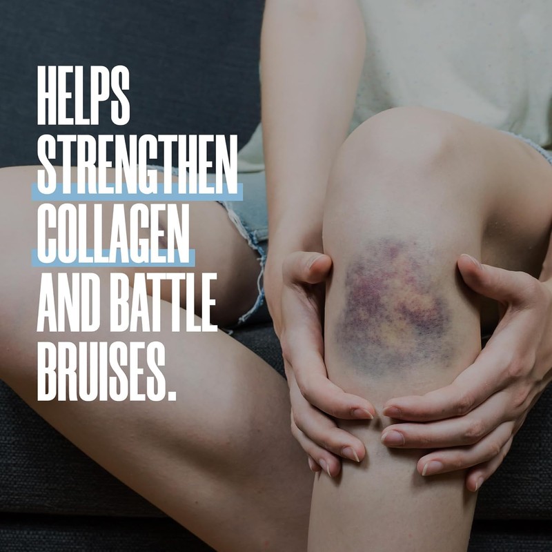 ZAX'S Bruise Vitamin Pharmacist Developed Bruising Supplements Potent Bruising Swelling
