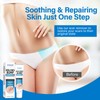 Keloid Bump Removal, Keloid Scar Treatment for Face, Body, Advanced