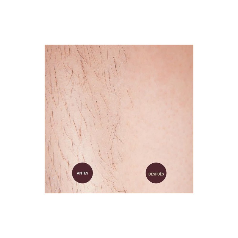 NAD'S 4903EN06 Sensitive Hair Removal Cream, 5.1 Ounce