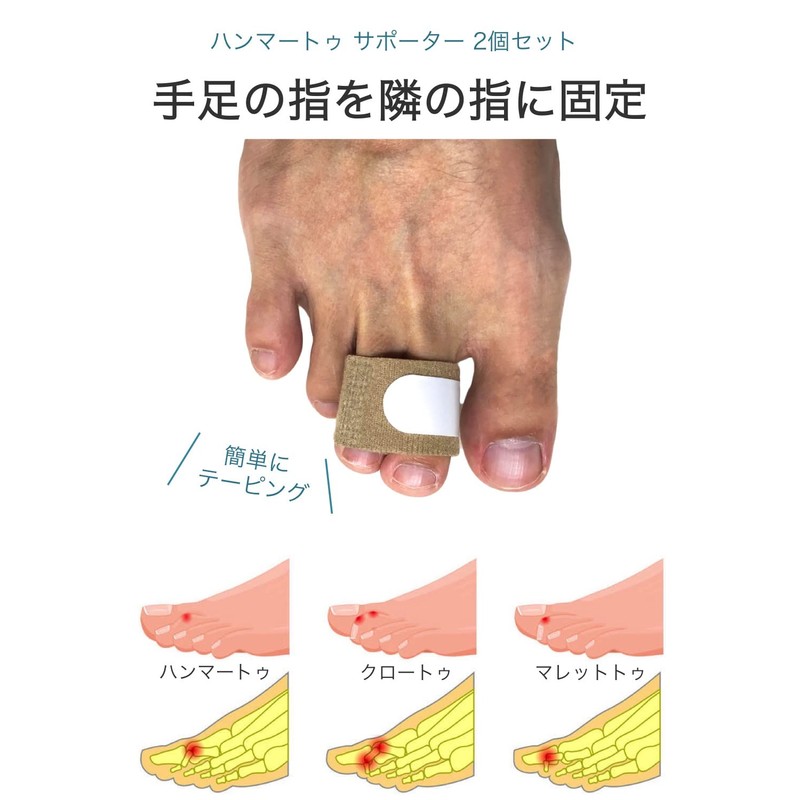 Wumio Hammer Toe Supporter, Set of 2, One Size Fits
