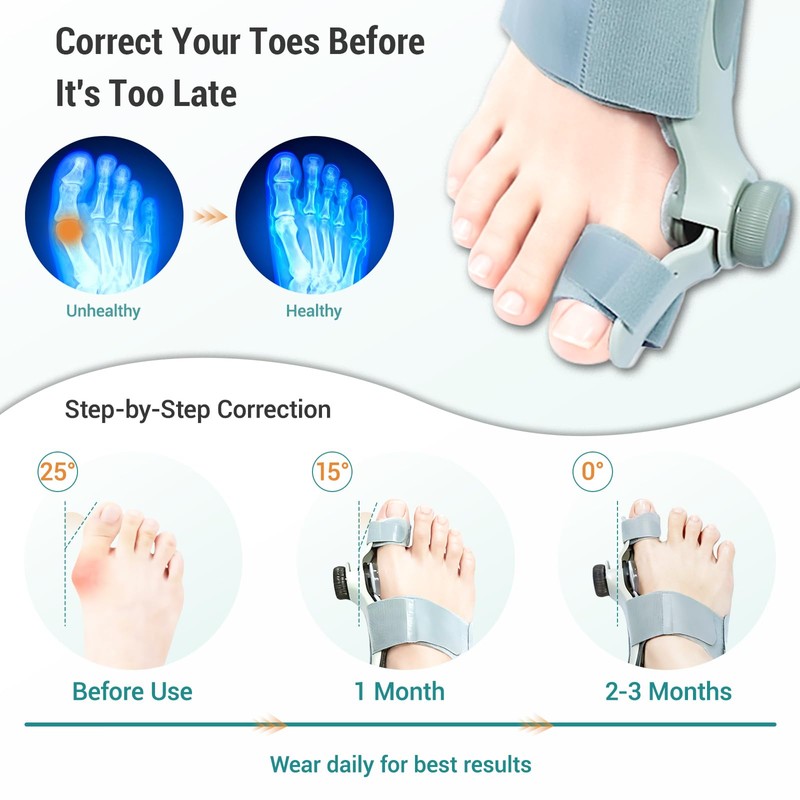 Bunion Corrector for Women Big Toe - US Patent 3