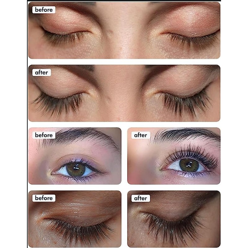 Toplash Lash & Brow Booster XL