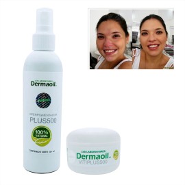 Loción Y Crema Con Melagenina Y Piperina Para Vitíligo.