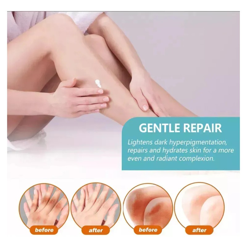 Fixderma Nigrifix Crema Acantosis Nigricans Fbgx2 Agua