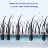 2 Pcs Anti-Dandruff Shampoo, Oil Control and Refreshing Formula, Hair