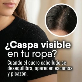 Limpieza Profunda y Equilibrio Capilar | Shampoo Alquitrán Essence Beauty Freedom 480 ml | Calma Picazón, Purifica y Regula el Sebo del Cuero Cabellud