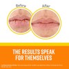 O'Keeffe's Lip Repair SPF 35 - Bálsamo labial (paquete de