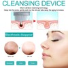 Professional Electric Facial Cleansing Brush Device Household Face Skin Pore