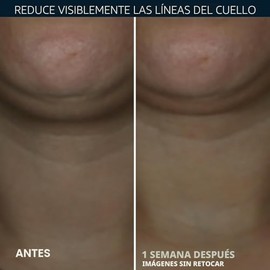RoC Derm Correxion Crema para el cuello con ácido hialurónico + Retinol avanzado para tensar y levantar visiblemente las líneas horizontales del cuell