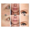 Forehead Wrinkle Frown Lines Removal Sticker Patch Moisturizing Nasolabial Folds
