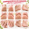 2PCS Cremas de Urea al 30% para Pies, Crema para
