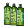 Yves Rocher | Set Shampoo Anticaspa | Sin Sulfatos |