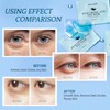 PEAUAMIE Under Eye Patchs Hyaluronic Acid Eye Mask for Dark