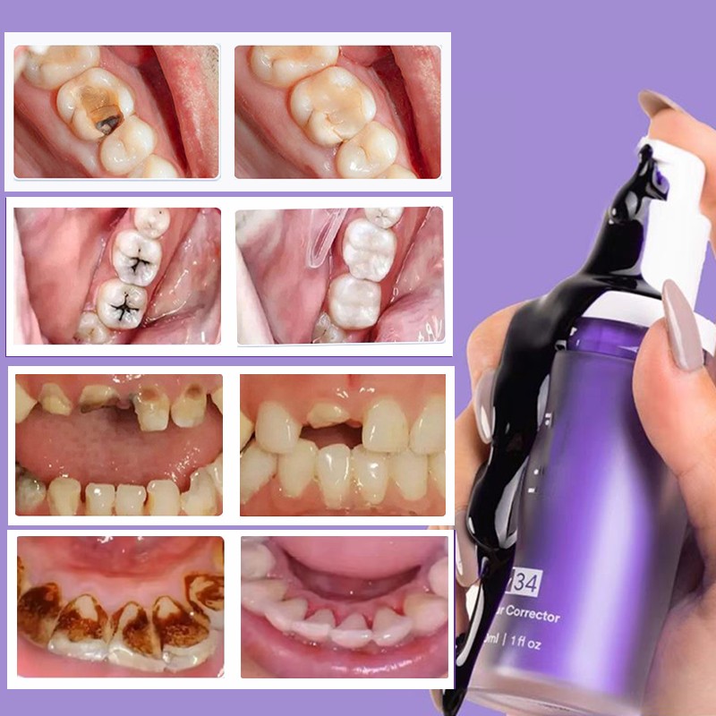 V34 purple toothpaste hismile colour corrector Whitening teeth karang gigi