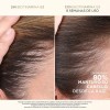 Tratamiento Dove Anti-caida Serum + Pantene Anticaida Serum