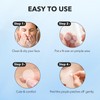 QUSTERE Pimple Patches for Face, Hydrocolloid Acne Patches, Cute Round
