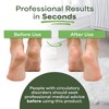 PEDI-WISE Double Sided Foot File - Extra Large Professional Foot