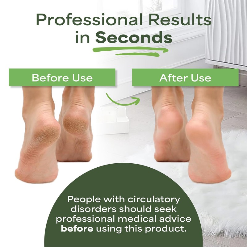 PEDI-WISE Double Sided Foot File - Extra Large Professional Foot