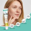 Crema Quita Melasma Manchas Por Edad Sol