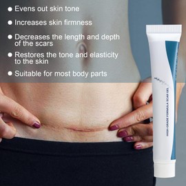 Apooliy Narbenentfernungs-Creme,Akne-Narben-Behandlung,Fade Narbe Marks Akne Haut Gel,Schnellwirkend,Körper-Gel für Verbrennungsnarben & Schnittnarbenentfernung