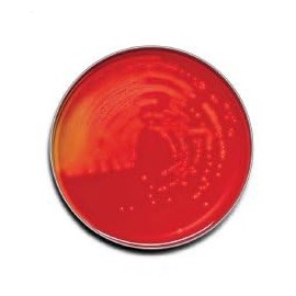 BD Medical Systems 221261 Trypticase Soy Agar with 5% Sheep Blood (TSA II) (Pack of 100)