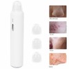 Blackhead Removal Suction Machine Grease Removal Electric Face Pore Cleaner