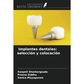 Implantes dentales: selección y colocación