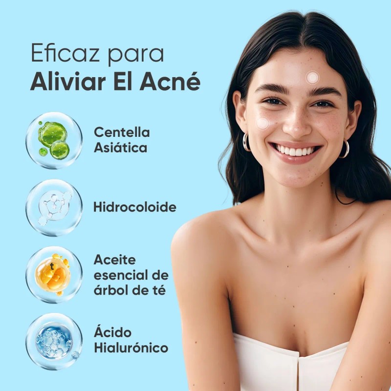 135 Parches Adhesivos Para El Acné, Parche Absorbente Para E