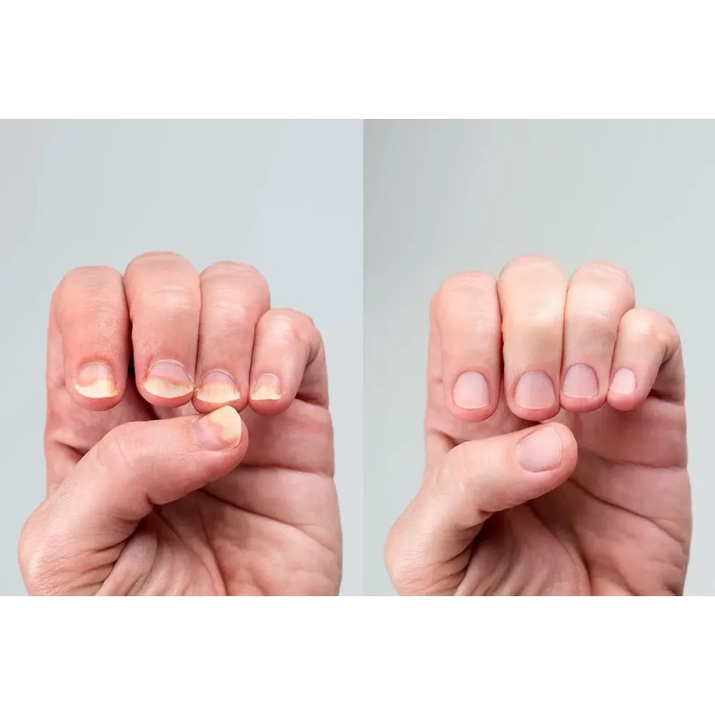 Aceite Fortalecedor de Uñas Miracle Fruit Oil Cutículas Crema