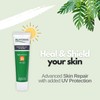 Alhydran SPF 30 | Advanced Skin Repair with added UV