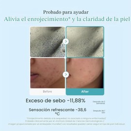 medicube Azelaic Acid Niacinamide Clarifying Toner  Troubled Skin Care, Ideal for Purifying  Calming  4 Azelaic Acid  2 Niacinamide Soothing Daily... 