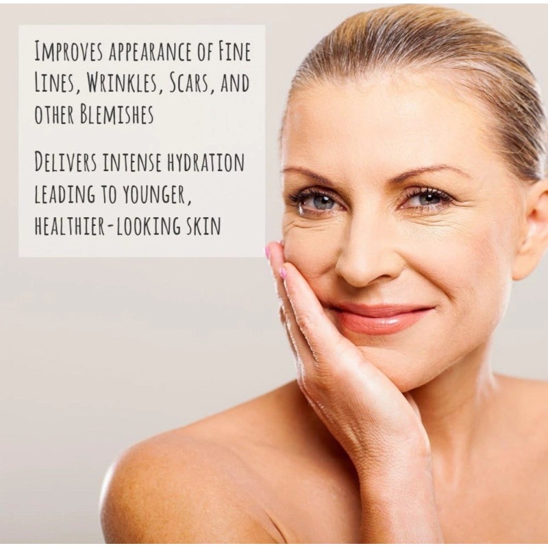 Body Merry Stretch Marks and Scars Defense Cream