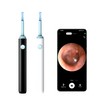 eXempt Ear Wax Removal Pick Led Wireless Ear Camera Otoscope
