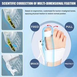 Bunion Corrector for Women & Men - Adjustable Big Toe Bunion Relief Toe Straightener Bunion Splints, Upgraded Press-Button Orthopedic Bunions Correction Suitable for Left/Right Feet -2PC Black