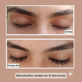 B-lashes Suero Crecimiento Pestañas Largas Origen Natural